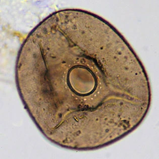 Arcella catinus