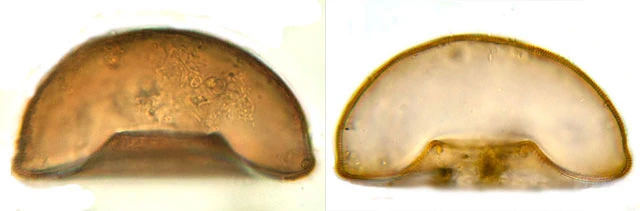 Arcella crenulata