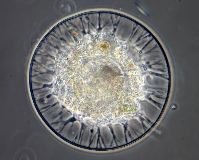 Arcella crenulata