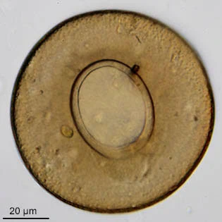 Arcella scutelliformis