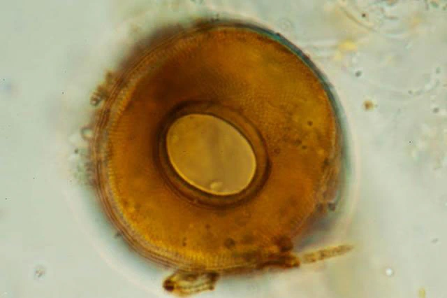 Arcella excavata