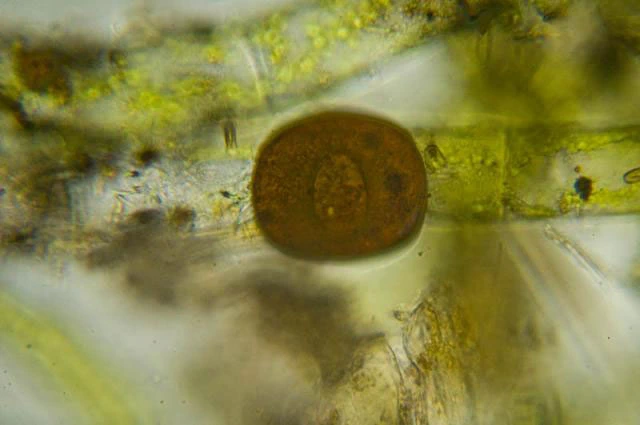Arcella excavata