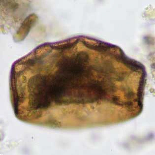 Arcella formosa