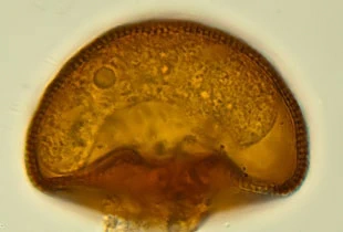 Arcella hemisphaerica