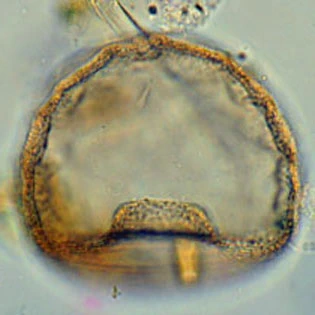 Arcella mitriformis