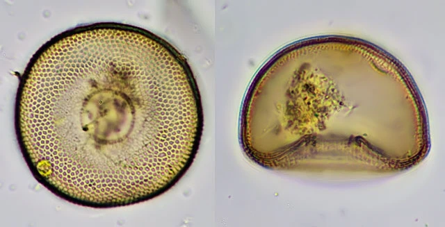 Arcella hemisphaerica