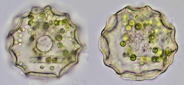 Arcella hemisphaerica undulata