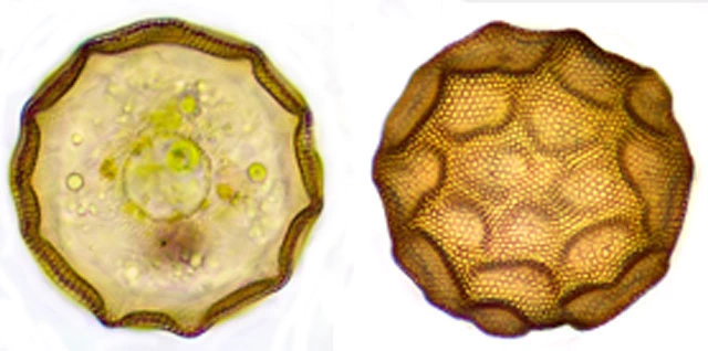 Arcella hemisphaerica undulata