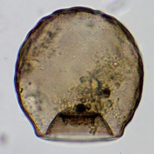Arcella mitrata