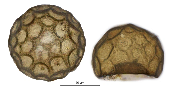 Arcella mitriformis