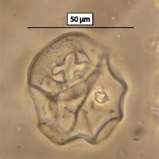 Arcella peruviana