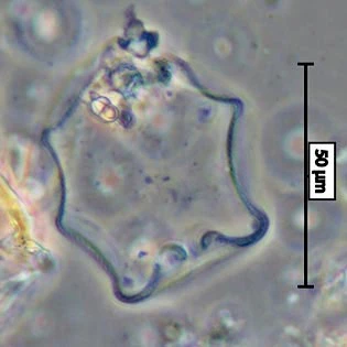 Arcella peruviana