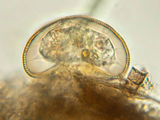 Arcella rotundata