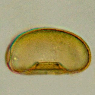 Arcella rotundata