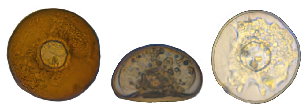 Arcella salobris