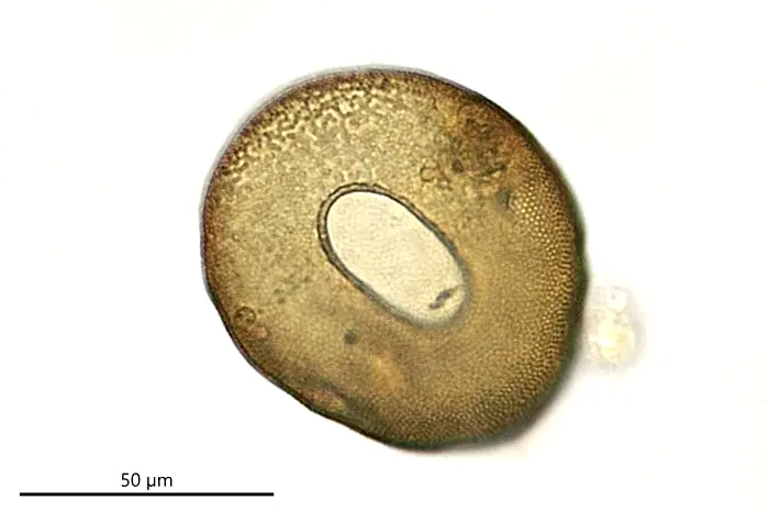 Arcella sp.