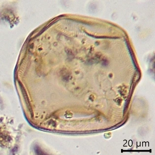 Arcella spectabilis