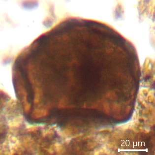 Arcella spectabilis