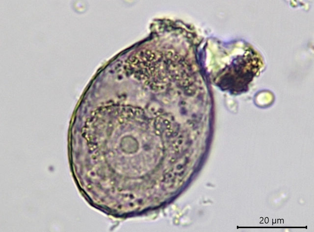 Assulina collaris
