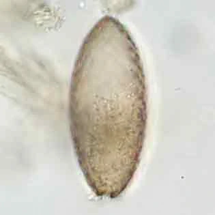 Assulina scandinavica