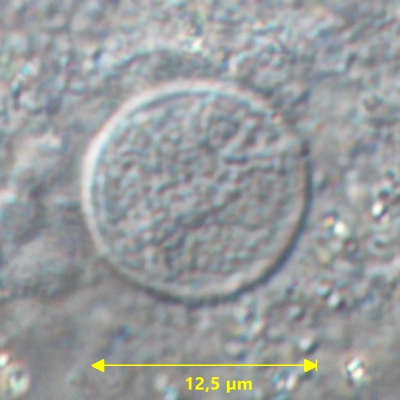 Centropyxis aculeata