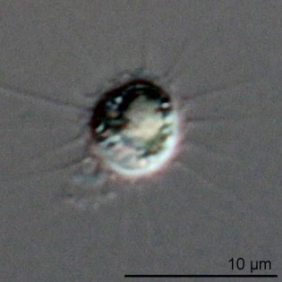 Belonocystis spec.