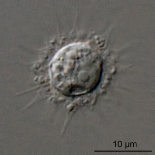 Belonocystis spec.