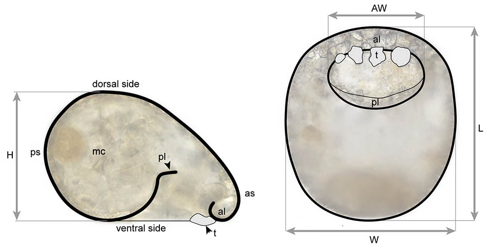 Centropyxis constricta