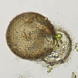 Centropyxis pontigulasiformis