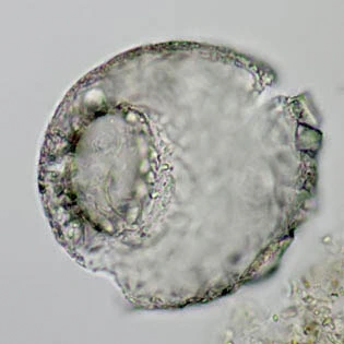 Centropyxis orbicularis