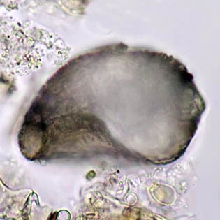 Centropyxis orbicularis