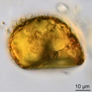 Centropyxis aerophila