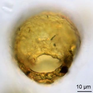 Centropyxis aerophila