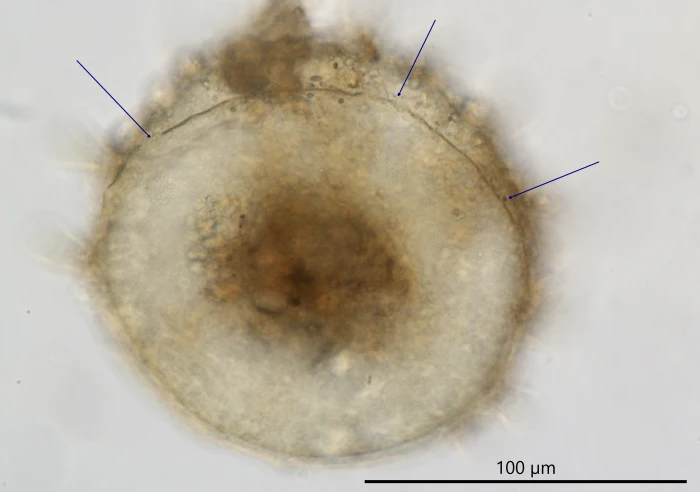 Centropyxis grandis