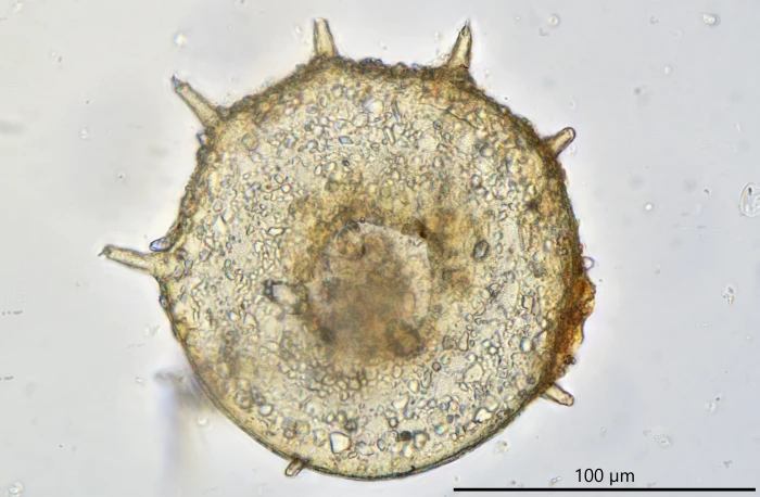 Centropyxis grandis