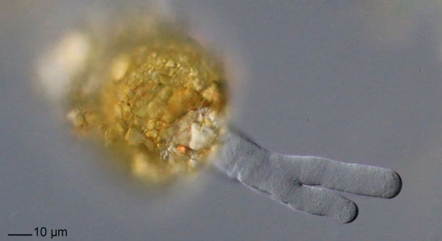 Centropyxis aerophila