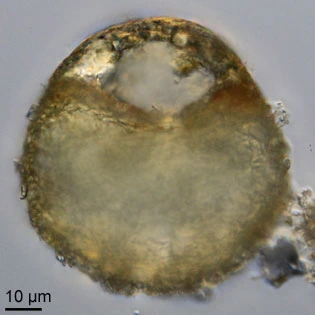 Centropyxis aerophila