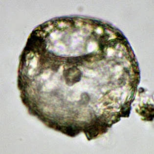 Centropyxis aerophila