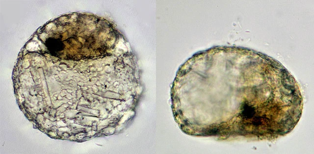 Centropyxis sylvatica