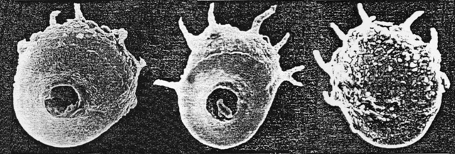Centropyxis bryophilus