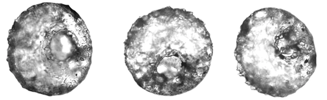 Centropyxis cavitastoma