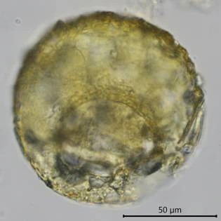 Centropyxis circularis
