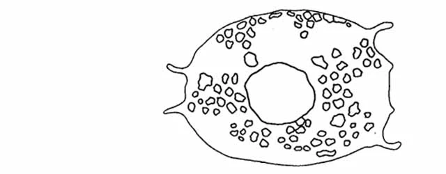 Centropyxis compressa