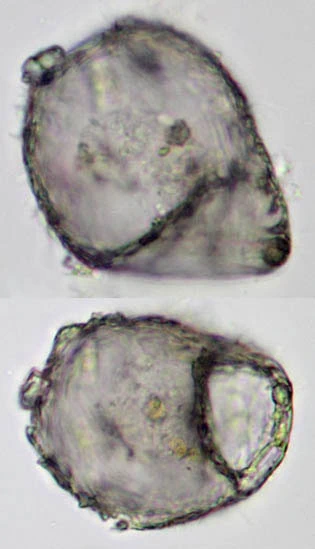 Centropyxis aerophila