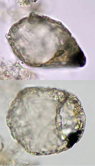 Centropyxis aerophila