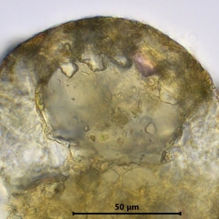 Centropyxis constricta