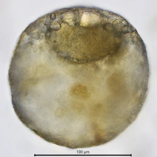 Centropyxis constricta