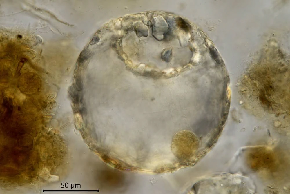 Centropyxis constricta