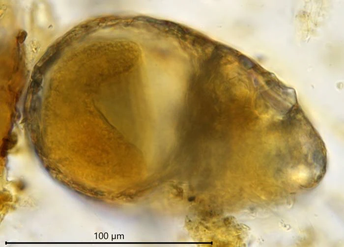 Centropyxis constricta