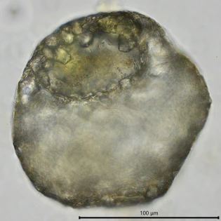 Centropyxis constricta